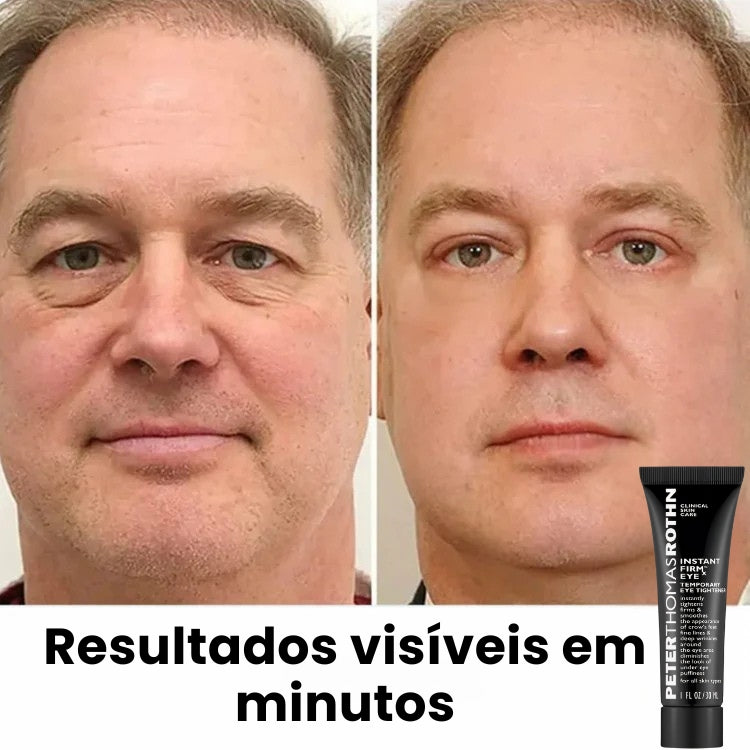 Creme Antirrugas Instant Beauty® Original [COMPRE 1 E LEVE 2 COM 50% DE DESCONTO]